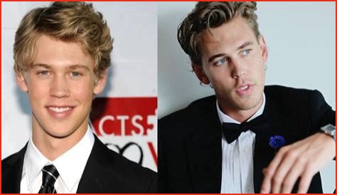 Did The Elvis Star Have Jawline Reconstruction Surgery and Nose Job? Fans Seek Before and After Pictures!