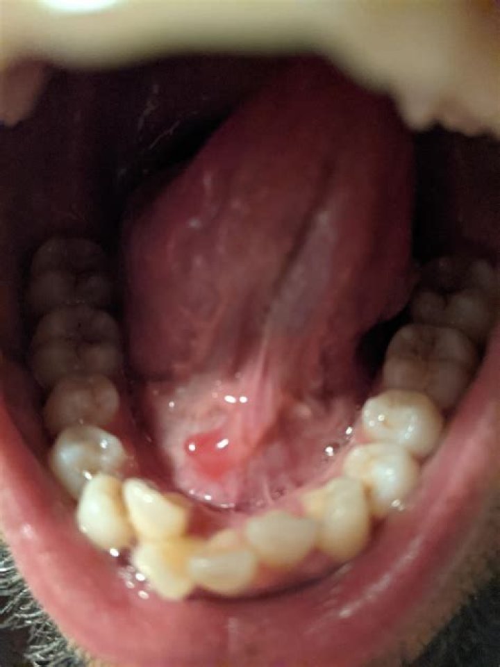 Putting Salt Under Your Tongue for ED: A Comprehensive Guide
