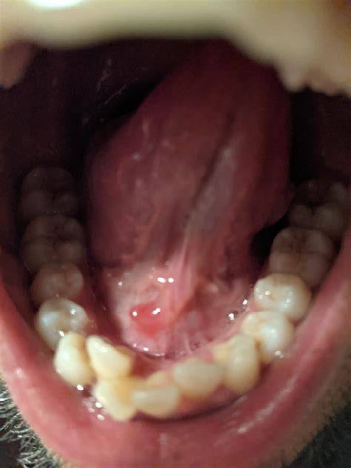 Salt Under Tongue to Get Hard: A Comprehensive Guide