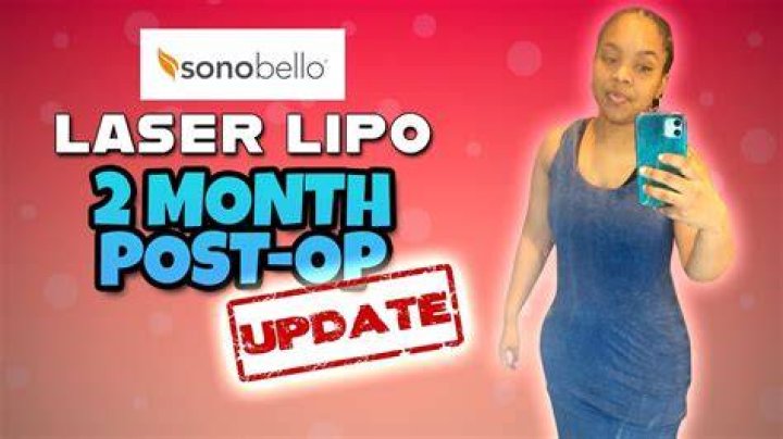 Sono Bello Nightmare: Patient Stories & Abex Procedure Review