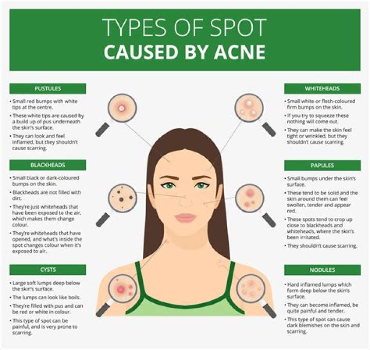Understanding Black Spot Pimples: Causes, Treatments, and Prevention