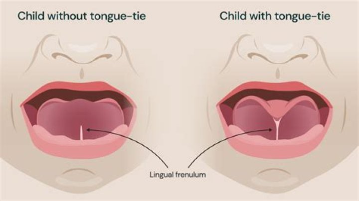Why Placing Salt Under the Tongue Could Transform Your Health